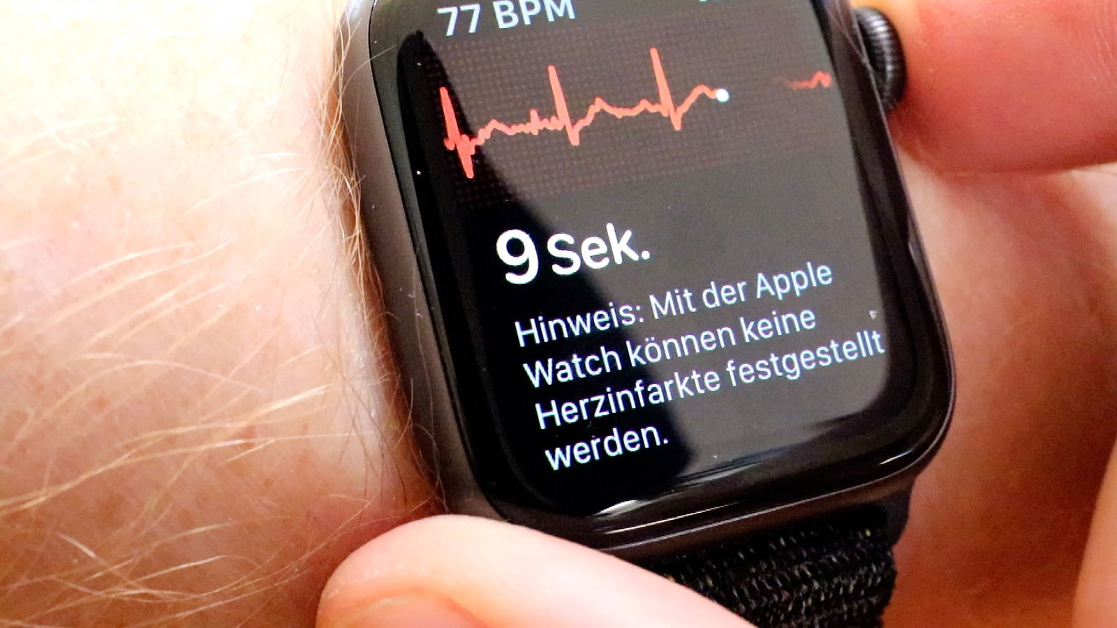 Daten aus der Apple Watch für die Forschung